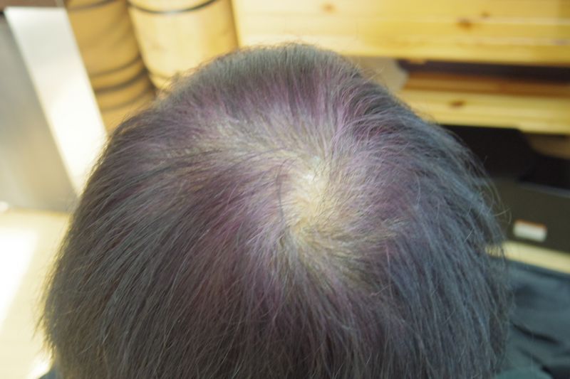 ハーブマホガニーで白髪の部分がしばらくすると紫色になる場合の対処法 仮 ハナヘナ Do Sヘアケアをわかりやすく解説 ハナヘナ知っトク情報満載